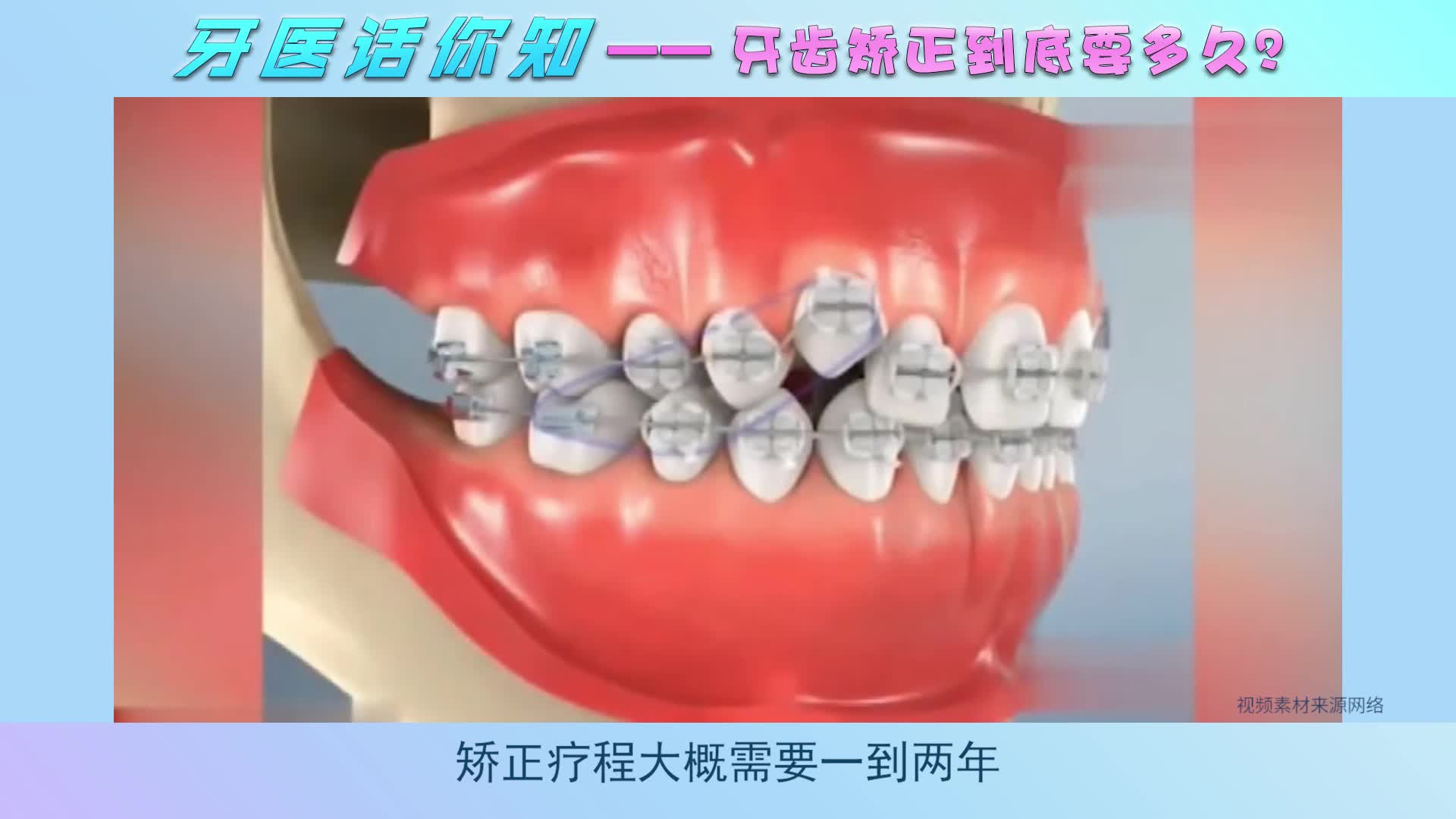 深圳矫正牙齿全过程 - 知乎